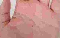 朱砂痣的爱情含义是什么_朱砂痣在爱情里的含义是什么
