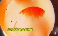 云南宝山南红玛瑙如何鉴别